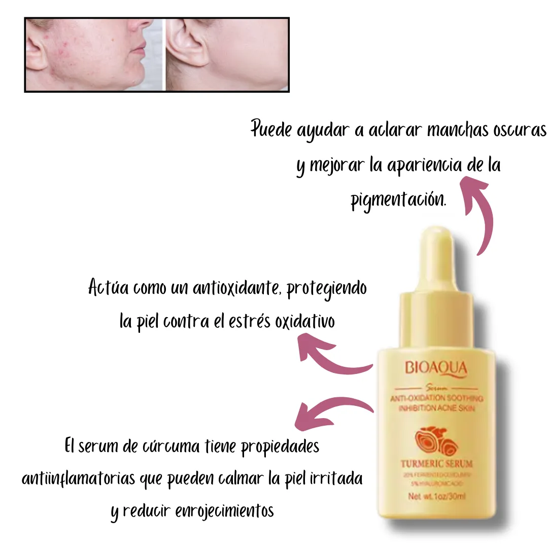 Kit x 3 de Sérums/Sueros Faciales: Nicotinamida, Cúrcuma y Baba de Caracol - BIOAQUA