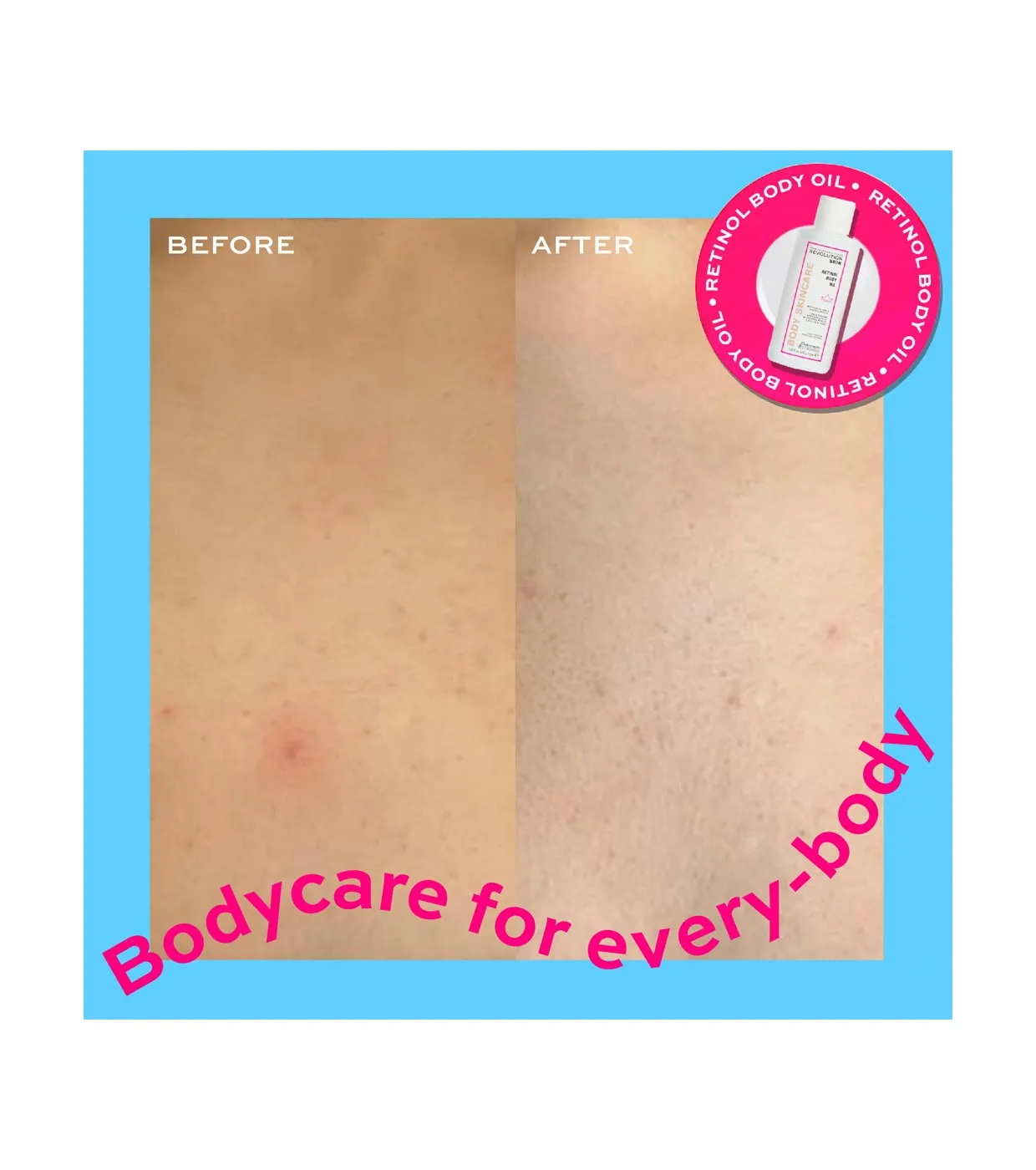 Revolution Skincare - *Body Skincare* - Aceite corporal de retinol