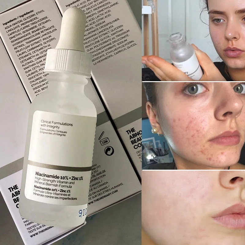 The Ordinary Niacinamide 10% + Zinc 1% (30ml) | Sérum Vitamina B3